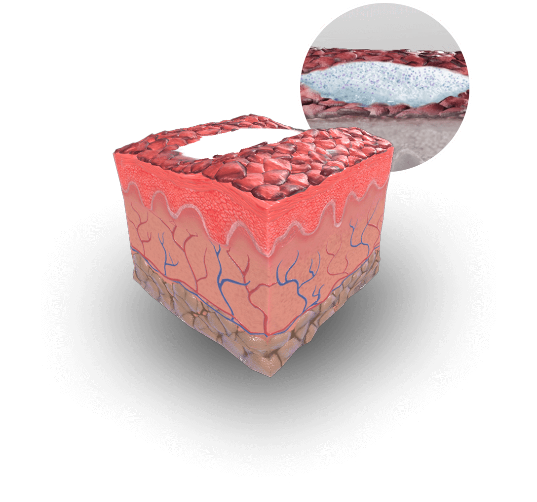 Case study Leopharma