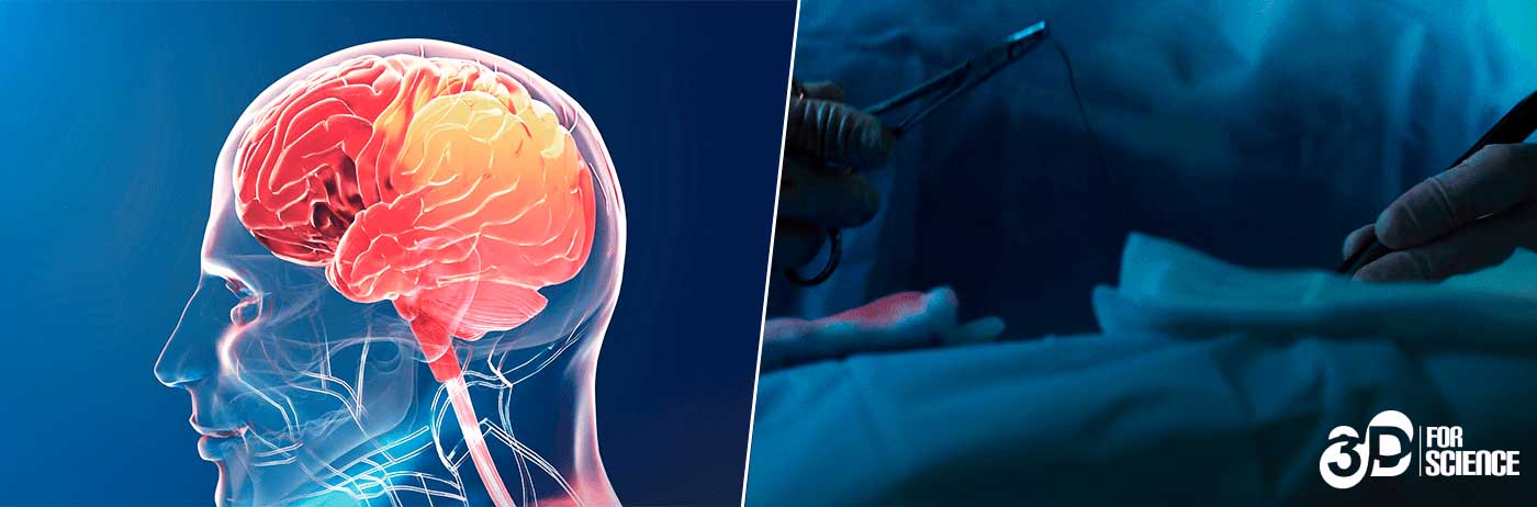 Head surgery virtual reality technology