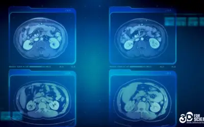 Beyond Images: The Future of Radiology Enhanced by 3D Animation