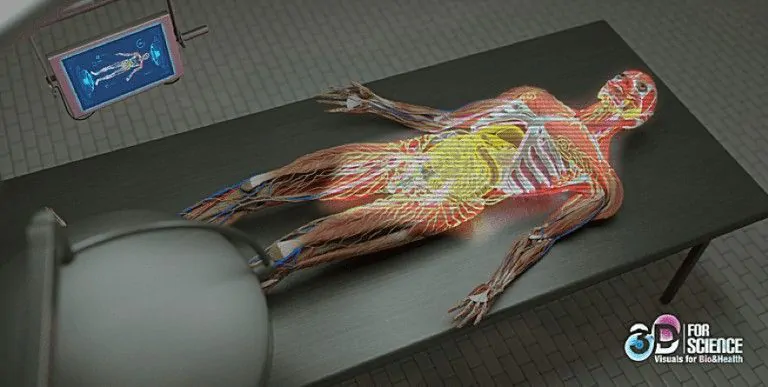 Holographic Medical Imaging of a body